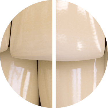 Voor/na het gebruik van Opalescence™-tandpasta